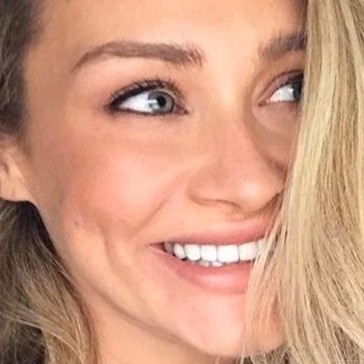 Laser Acne Treatment After 2